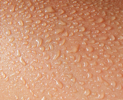 Lenisfera psoriasi Lenisfera psoriasi